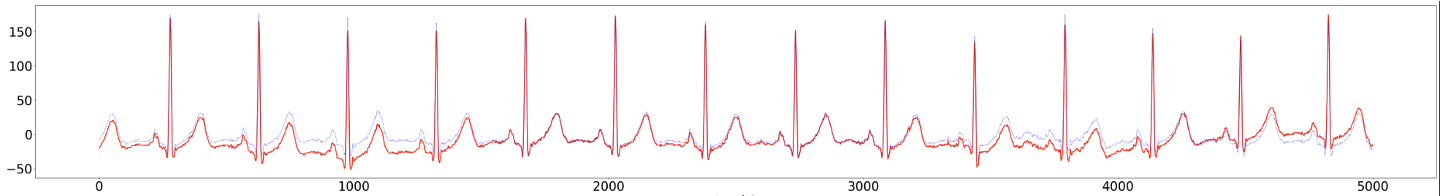 A Survey of Augmentation Techniques for Self-Supervised ECG Contrastive Learning
